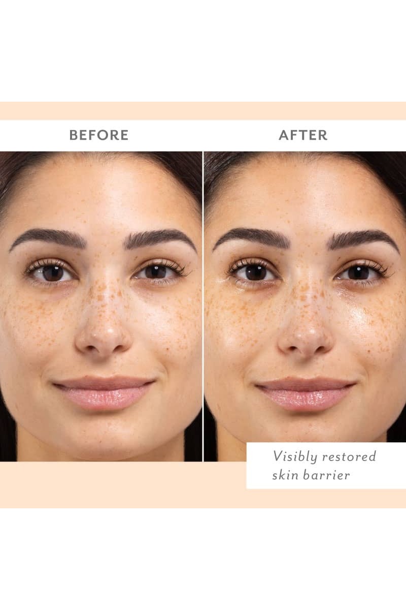 Skin Remedy Barrier-Boosting Sheet Mask
